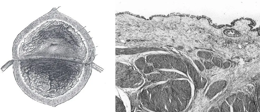 Rak prostaty jest częstym nowotworem u mężczyzn. Obraz gruczołu krokowego, rysunek poglądowy oraz obraz mikroskopowy.