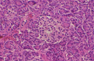 Prawidłowy obraz histologiczny trzustki. Przed cierpieniem związanym z piciem.