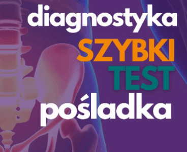 Łukasz Poniatowski, fizjoterapeuta, odstronyfizjo, diagnostyka pośladka szybki test.