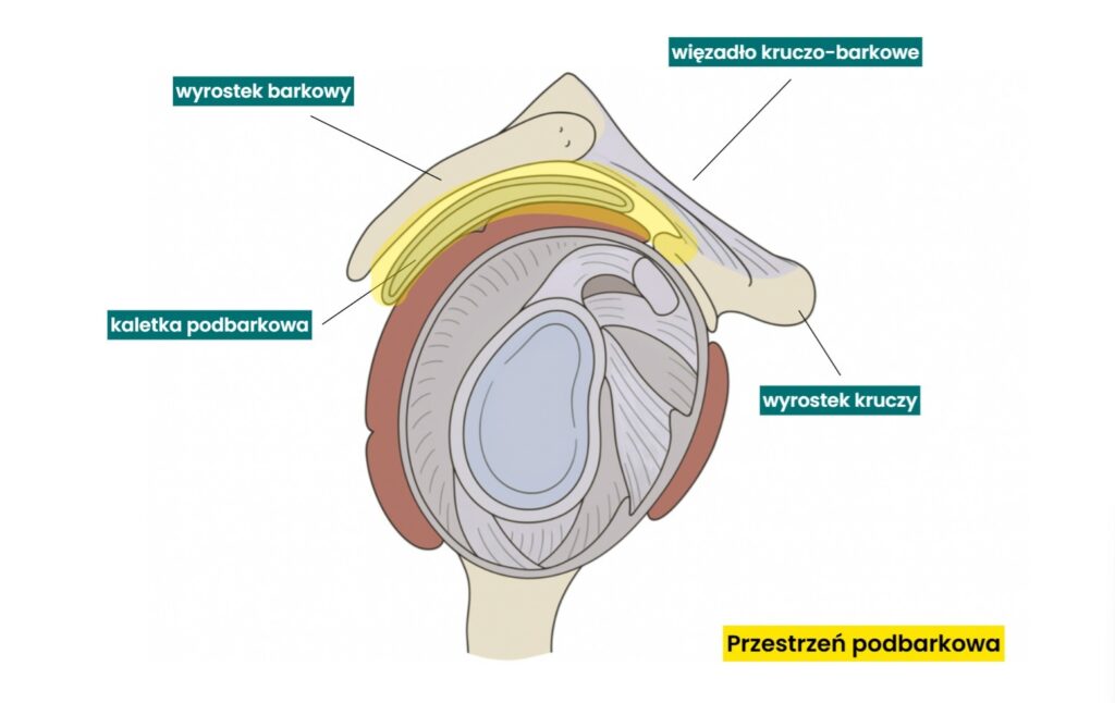 Zespół bolesnego barku - to w stożku rotatorów na ogół tkwi przyczyna.