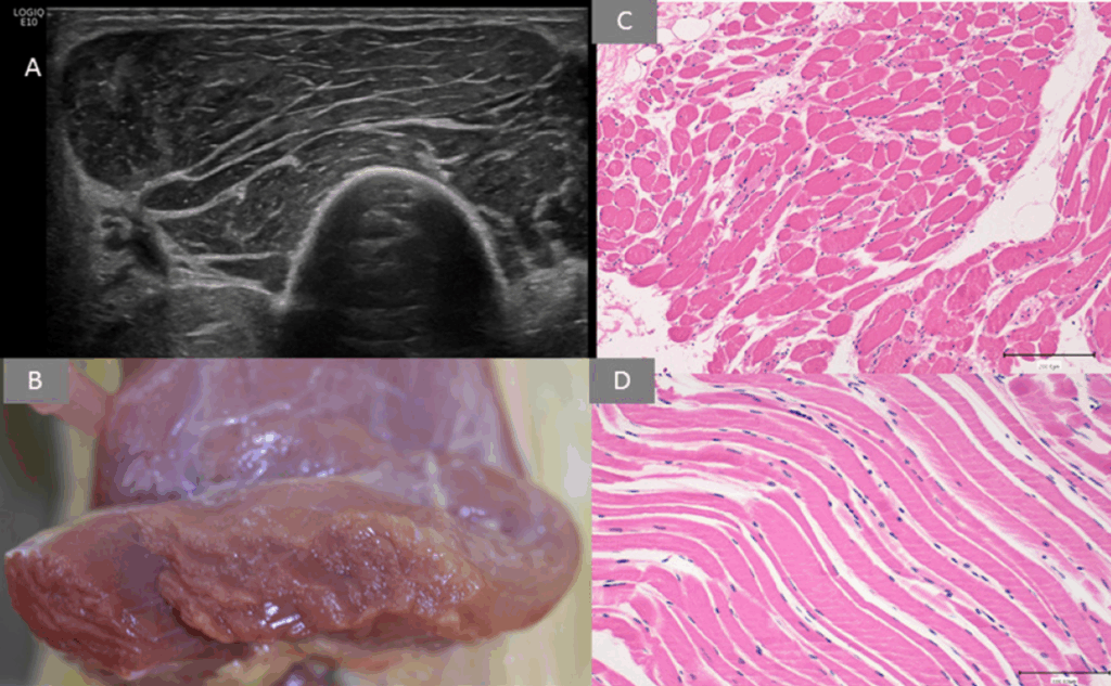 Sarkopenia, czy kreatyna może przywrócić funkcję mięśni?. Preparaty normalnego mięśnia. Widok USG, preparat pośmiertny oraz histologiczny.