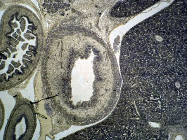Przegląd wątroby w życiu płodowym. Główny narząd detoksykacji ustroju.
