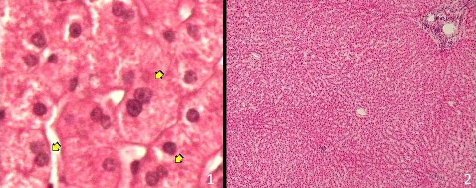 Wątroba - widok mikroskopowy uwidacznia hepatocyty.